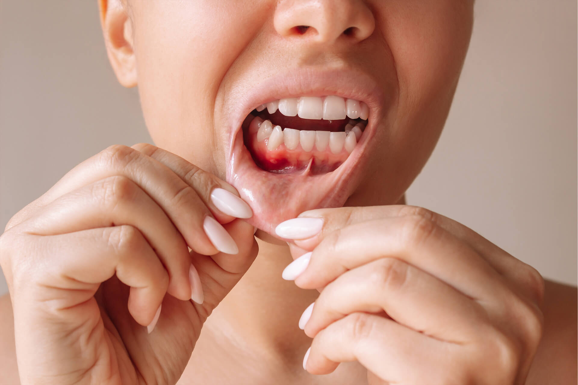 Periodontologia